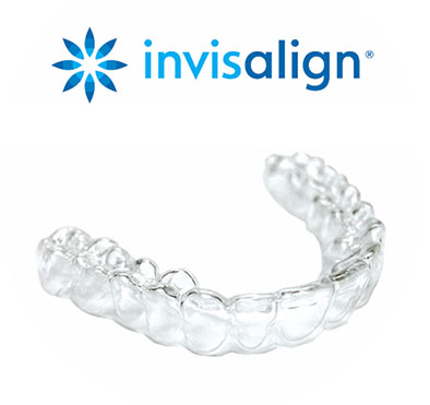braces-invisalign